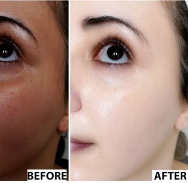White Now Super Fast Triple Action Skin Whitening Lotion imagen 4