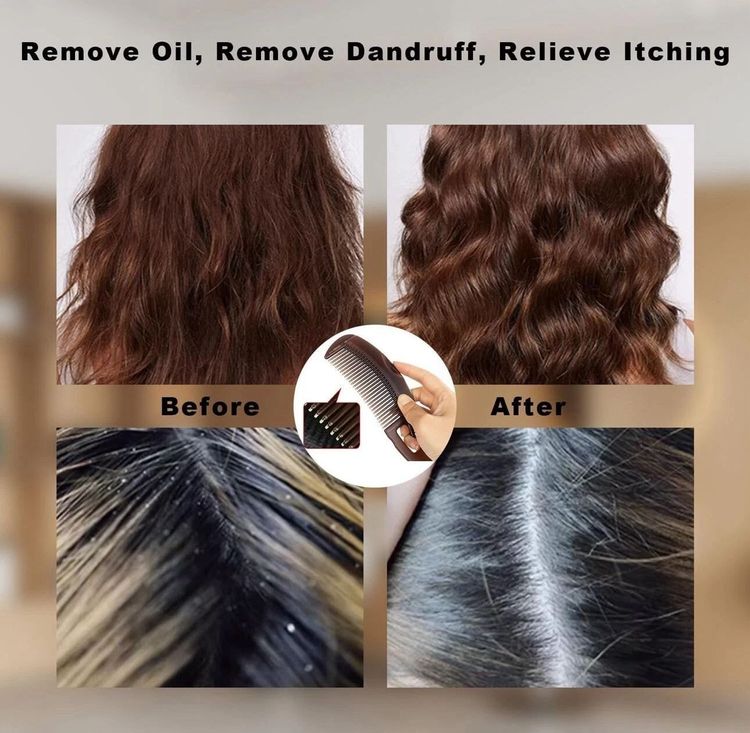 Other hair comb for dandruff RRP 5£ product image